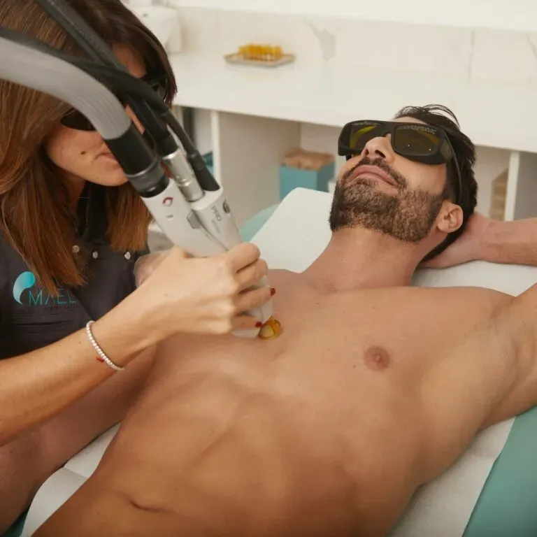Homme recevant un traitement d'épilation laser au torse